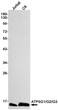 Western blot analysis of ATP5G1/G2/G3 in Jurkat, C6 lysates using ATP5G antibody.