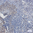ATPB antibody immunohistochemistry human tonsil STJA0011009