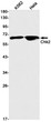 Western blot analysis of Chk2 in K562, Hela lysates using Chk2 antibody.