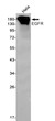 Western blot analysis of EGFR in Hela lysates using EGFR antibody.