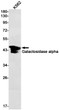 Western blot analysis of Galactosidase alpha in K562 lysates using Galactosidase alpha antibody.