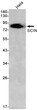 SCIN antibody western blot HeLa lysates STJA0011939