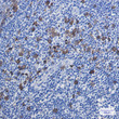 Thymidylate Synthase antibody immunohistochemistry human tonsil STJA0012053