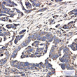 WDR1 antibody immunohistochemistry human cholangiocarcinoma STJA0012136