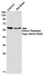 ACVR2B antibody western blot CHO-K1 mouse brain STJA0012257