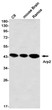 Western blot analysis of Arp2 in C6, mouse Brain, Ramos lysates using Arp2 antibody.