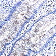 Entactin/NID antibody immunohistochemistry human colon cancer STJA0012361