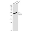 Western blot analysis of FADS1 in rat brain, rat liver lysates using FADS1 antibody.