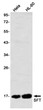 Western blot analysis of SFT in Hela, HL-60 lysates using SFT antibody.