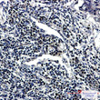 RING2/RING1B/RNF2 antibody immunohistochemistry human lung cancer STJA0012662