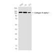 Western blot analysis of Collagen III in K562, C6, 3T3 lysates using Collagen III alpha 1 antibody.
