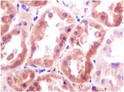 Immunohistochemistry analysis of paraffin-embedded Human fetal kidney using klotho antibody. High-pressure and temperature Sodium Citrate pH 6. 0 was used for antigen retrieval. Immunohistochemistry analysis of paraffin-embedded Human fetal kidney using klotho antibody. High-pressure and temperature Sodium Citrate pH 6. 0 was used for antigen retrieval.