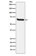 Western blot analysis of Klotho in Human fetal kidney lysates using Klotho antibody. Western blot analysis of Klotho in Human fetal kidney lysates using Klotho antibody.
