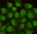 Immunocytochemistry analysis of Rad23B (5H1) in HeLa using hHR23b antibody.