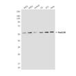 Western blot analysis of hHR23b in A431, K562, Jurkat, C6, 3T3 and Hela lysates using hHR23b antibody.