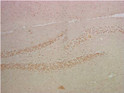 NFKB p65 antibody immunohistochemistry mouse hippocampus STJA0012889