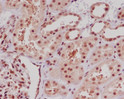 ERG antibody immunohistochemistry human kidney paraffin-embedded STJA0014548