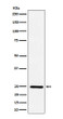 Ephrin A1 antibody western blot HUVEC TNF alpha STJA0015508