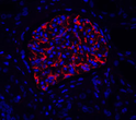 IF analysis of nestin. Sample: Human kindey, 4% PFA 12-24h. Antigen retrieval: Citrate buffer, pressure cooker 2min. Blocking buffer: 3% BSA in PBS, RT, 30min. Primary antibody: 1:500, 4C overnight. Secondary antibody: Cy3 conjugated Goat Anti-mouse IgG, 1:200 RT 1h.