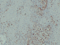 Anti-S100A4 antibody [SM5058] (STJA0005058)