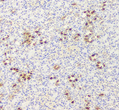 Immunohistochemistry of paraffin embedded rat kidney using calb1 at dilution of 1:500