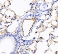 Immunohistochemistry analysis of CD31. Sample: mouse lung, 4% PFA 12-24h. Antigen retrieval: Citrate buffer, pressure cooker 2min. Blocking buffer: 3% BSA in PBS, RT, 30min. Primary antibody: 1:1500, 4C overnight. Secondary antibody: HRP Goat Anti-mouse lgG, 1:200 RT 1h.