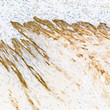 Anti-Cytokeratin 14 antibody [SM5119] (STJA0005119)