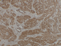 Anti-Caldesmon/CDM antibody [SM5135] (STJA0005135)