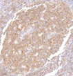 Immunohistochemistry analysis of paraffin embedded human tonsil using CD20 at dilution of 1:200