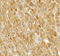 Anti-Desmin antibody [SM5174] (STJA0005174)
