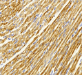 Immunohistochemistry of paraffin embedded rat heart+LPS using Desmin at dilution of 1:500