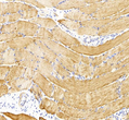 Immunohistochemistry of paraffin embedded rat skeletal muscle using Desmin at dilution of 1:500