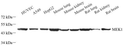 Western blot analysis of MEK1 at dilution of 1:1000