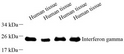 Western blot analysis of IFN Gamma at dilution of 1:1000