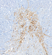 Immunohistochemistry analysis of Acetylcholinesterase. Sample: Rat Spinal cord, 4% PFA 12-24h. Antigen retrieval: Citrate buffer, pressure cooker 2 min. Primary antibody: 1:1000, 4C overnight. Secondary antibody: HRP conjugated Goat Anti-mouse lgG, 1:200, RT, 1h.