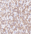 Anti-Claudin18.2 antibody [SM0394] (STJA0010394)