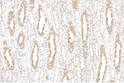 Immunohistochemistry analysis of paraffin-embedded human kidney using MYH10 at dilution of 1:4000