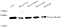 Anti-Peroxiredoxin 2/PRP antibody [SM0428] (STJA0010428)