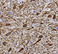 Immunohistochemistry analysis of TH. Sample: Rat brain, 4% PFA 12-24h. Antigen retrieval: Citrate buffer, 98C, 20 min. Blocking buffer: 3% BSA in PBS, RT, 30min. Primary antibody: 1:1500, 4C overnight. Secondary antibody: HRP Goat Anti-mouse lgG, 1:200 RT 1h.
