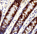 Immunohistochemistry of paraffin embedded human colon using MAC-2 at dilution of 1:1000
