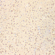 Immunohistochemistry analysis of HSP90. Sample: Rat brain, 4% PFA 12-24h. Antigen retrieval: Citrate buffer, pressure cooker 2min. Blocking buffer: 3% BSA in PBS, RT, 30min. Primary antibody: 1:1000, 4C overnight. Secondary antibody: HRP Goat Anti-mouse lgG, 1:200 RT 1h.