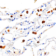 Immunohistochemistry analysis of CD68. Sample: Human lung, 4% PFA 12-24h. Antigen retrieval: Citrate buffer, pressure cooker 2 min. Primary antibody: 1:1000, 4C overnight. Secondary antibody: S-vision poly-HRP conjugated Goat Anti-mouse lgG, Ready to use, RT, 20min.