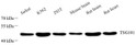 Western blot analysis of TSG101. Sample: Protein treated by RIPA Lysis Buffer. Blocking buffer: 3% Nonfat dry milk in TBST, RT, 1h. Primary antibody: 1:1000, 4C overnight. Secondary antibody: HRP Goat Anti-mouse lgG, 1:3000, RT, 1h.