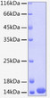 Recombinant Human Cystatin-A/CSTA Protein was determined by SDS-PAGE with Coomassie Blue, showing a band at 14 kDa.