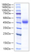 Recombinant Rat ALK-4/ACVR1B Protein was determined by SDS-PAGE with Coomassie Blue, showing a band at 40-50 kDa.