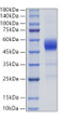 Recombinant Rat ALK-1/ACVRL1 Protein was determined by SDS-PAGE with Coomassie Blue, showing a band at 45-60 kDa.