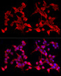 Flow cytometry: 1X10^6 K-562 cells (negative control, left) and A-431 cells (right) were surface-stained with Purified Rabbit anti-Human E-Cadherin mAb (5 Mu l/Test, orange line) or secondary antibody only (blue line). Non-fluorescently stained K-562 and A-431 cells were used as blank control (red line). ABflo® 594-conjugated Goat Anti-Rabbit IgG (H+L) (STJS001186, 1:1000) was used as a secondary antibody.