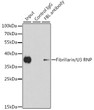 Immunoprecipitation analysis of 200 Mu g extracts of HeLa cells using 1 Mu g Fibrillarin/U3 RNP antibody (STJ11106039). Western blot was performed from the immunoprecipitate using Fibrillarin/U3 RNP antibody (STJ11106039) at a dilution of 1:1000.