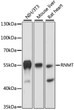 Western blot analysis of various lysates using RNMT Rabbit pAb (STJ11106059) at 1:3000 dilution. <br/>Secondary antibody: HRP-conjugated Goat anti-Rabbit IgG (H+L) (STJS000856) at 1:10000 dilution. <br/>Lysates/proteins: 25 Mu g per lane. <br/>Blocking buffer: 3% nonfat dry milk in TBST. <br/>Detection: ECL Basic Kit <br/>Exposure time: 30s.