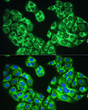 Immunofluorescence analysis of U2OS cells using YTHDF1 Rabbit pAb (STJ11106082) at dilution of 1:100. Secondary antibody: Cy3-conjugated Goat anti-Rabbit IgG (H+L) (STJS001166) at 1:500 dilution. Blue: DAPI for nuclear staining.